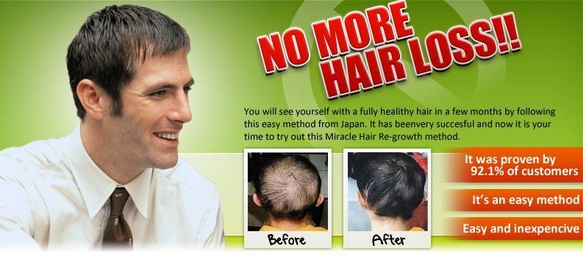 How To Reduce Hair Fall | How “Miracle Hair Regrowth” Helps People Stop Hair  Loss Permanently – 