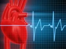 Granuflo: serious adverse events