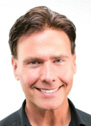 Tommy Lee Thomas Before After Hair Replacement Photos