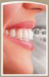 Attend ‘Invisalign Day’ and Learn How To Obtain A Straight Smile...