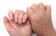 5 Tips for Living with Arthritis, from The CareGiver Partnership