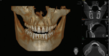 Cutting-Edge 3-D Technology at Midtown Dentistry Reduces Patient X-Ray...