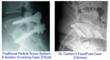 Dr. Jeffrey Carlson Successfully Performs Procedure Using...