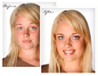 Dermasis Psoriasis Treatment Cream for Men and Women Released Online...