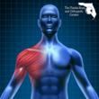Minimally-Invasive Shoulder Arthroscopy: How to Beat Shoulder Pain and...
