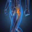 New Lawsuit on Faulty Hip Replacement: Now, AttorneyOne Can Provide...