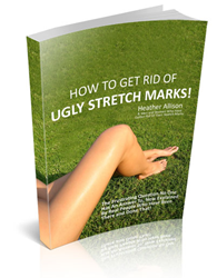 how to remove stretch marks review