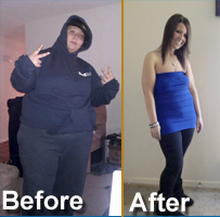 gastric bypass success story