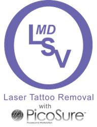 Maryland Laser Tattoo Removal