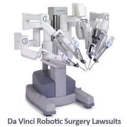 da vinci robotic surgery lawsuit
