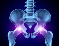 Hip Replacement: serious complications