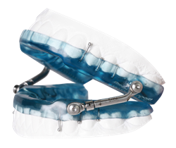 Sleep Herbst Manufactured By Gergen's Orthodontic Lab sleep apnea ppha pro player health alliance david gergen