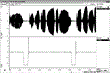 Biofeedback May Prolong Career of Wind Instrument Musicians