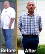 Extraordinary Gastric Bypass Performed by Dr. Nilesh Patel Helps Once...