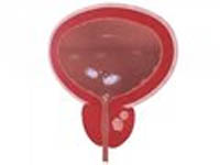Allen’s Device for prostate treatment helps to recover from chronic prostatitis and BPH