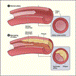 Siragusa Vein and Vascular Publishes Article to Raise Awareness of...