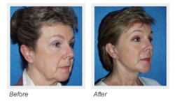 SK Clinic Announces New Web Reviews Page