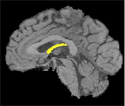 Photo of brain
