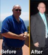 Texas Bariatric Specialists is Pleased to Announce that a Gastric...