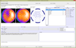 Syntermed Media Advisory: Emory Toolbox 4.0 and SmartReport Showcased at ASNC, September 26-29, Booth 516