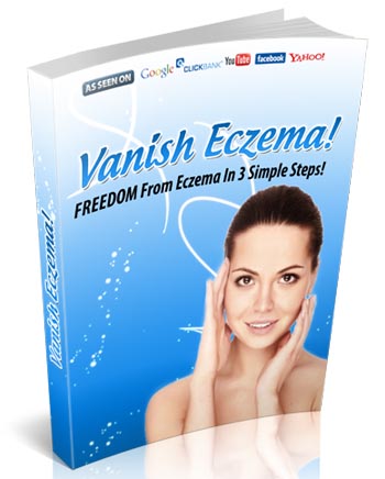 Natural Remedies for Eczema | “Vanish Eczema” Teaches People How to Eliminate Eczema Naturally - V-kool