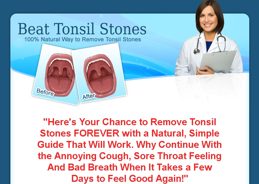 Natural Remedies For Tonsil Stones How “Beat Tonsil Stones” Helps People Get Rid Of Bad Breath