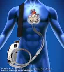 SynCardia, Total Artificial Heart, artificial heart, Freedom driver, heart failure, heart transplant, donor heart