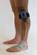 Chronic Wounds and High Risk Surgical Incisions Successfully Treated...