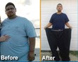Dr. Nilesh A. Patel is Thrilled to Announce Phenomenal Gastric Bypass...
