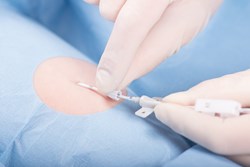Improves catheter placement