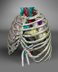 Perfusion Journal, SynCardia, Total Artificial Heart, artificial heart, heart failure, bridge to transplant, heart transplant, donor heart, biventricular failure