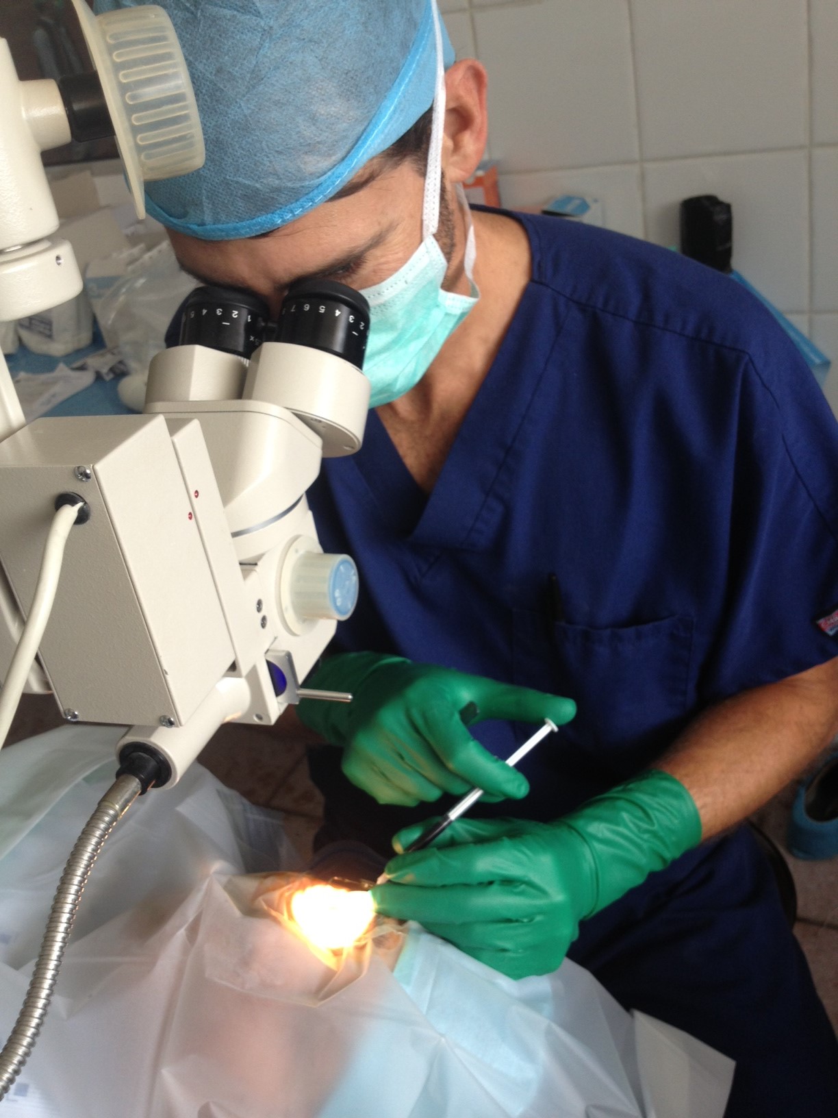 Cataract surgery san diego