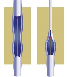 Siragusa Vein and Vascular is launching a new public health campaign via social media to promote minimally invasive forms of vein treatment