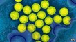 UOSSM Reports Several Cases of Suspected Polio in the Province of Die...