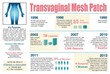 Injury Lawyer Comments on the Recent Settlement of Transvaginal Mesh...