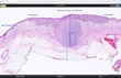 Kitware Develops Transformative Open-Source Digital Pathology System