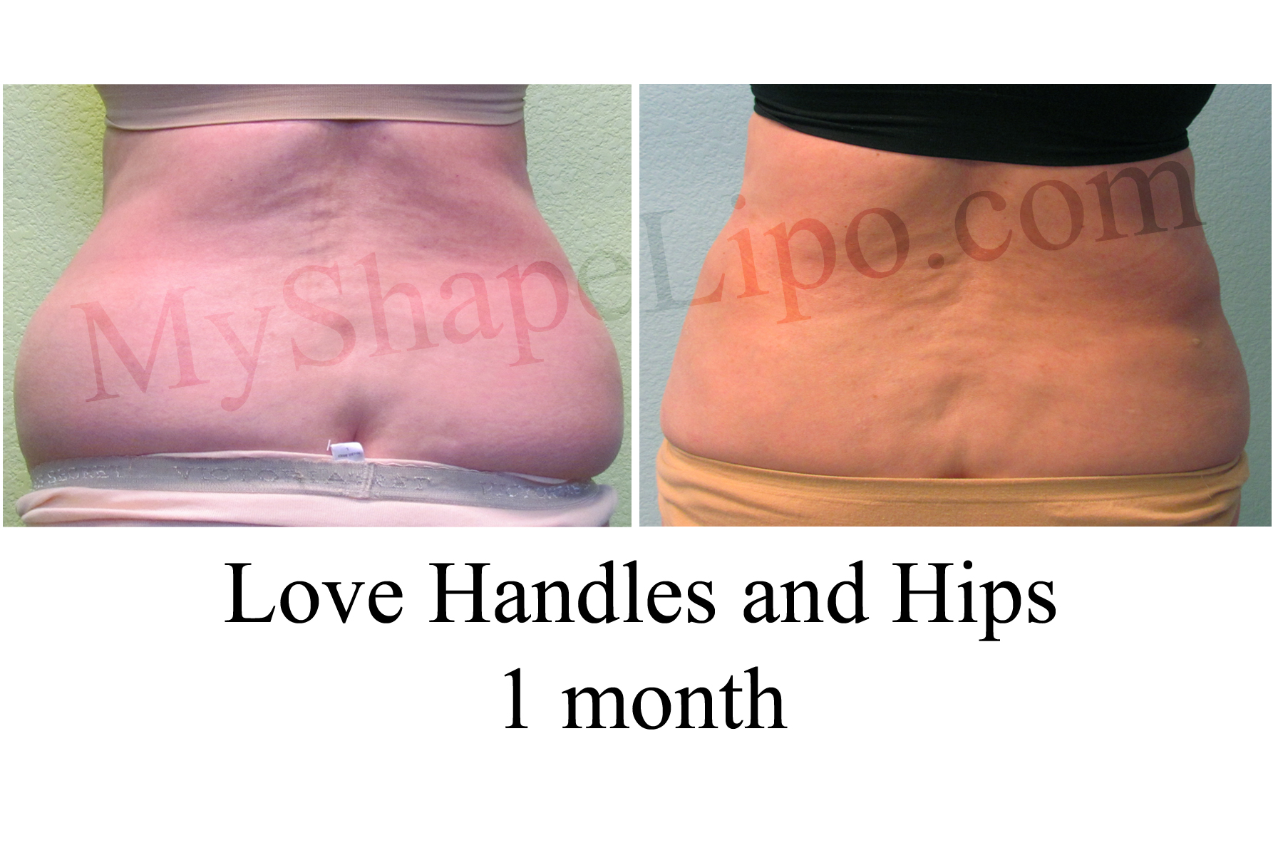 bad love handles