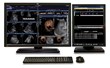 Imorgon Showcases Integrated Ultrasound Solutions at RSNA 2013