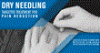 Athletico Physical Therapists Provide Pain Relief with Dry Needling...