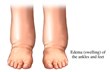 New York Cardiovascular Associates Launches Educational Campaign on...