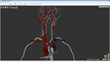 Endovascular Neurosurgery on Real Patients in a Simulated Environment