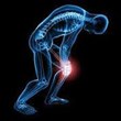 New Lawsuit Alleges Complications from Zimmer NexGen Knee Implant:...