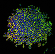 InSphero Publishes 3D Tumor-Stroma Model for Non-Small Cell Lung...