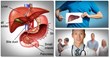 Get To Know 18 Tips on How to Improve Liver Function -...