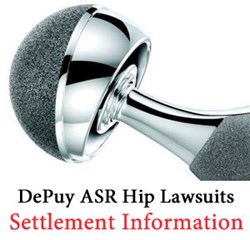 For information on this DePuy ASR Hip Settlement or if you have experienced DePuy ASR hip replacement side effects contact Wright & Schulte at www.yourlegalhelp.com, or by call 1-800-399-0795