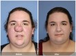 This Thanksgiving, a Newport Beach Facial Plastic Surgeon Has Given a...