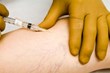 Treatment of Vein Disease: Front Line