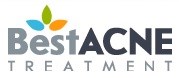 best acne treatment
