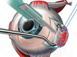 Medical Legal Art Launches New Medical Demonstrative Evidence Website