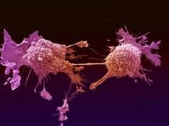 Actos: serious adverse events